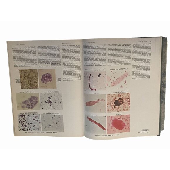 Netter's CIBA Medical Illustrations: Kidneys, Ureters, Bladder, Vol 6 - Picture 5 of 7